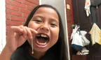 👧 Monkey-B Extracted Her Own Tooth 🦷 (An Accidental Post Save) thumbnail